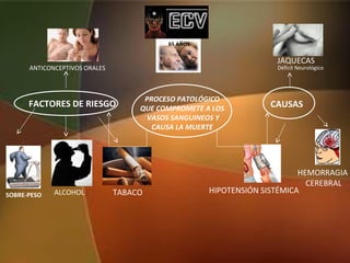 CAUSAS
HEMORRAGIA
CEREBRAL
JAQUECAS
HIPOTENSIÓN SISTÉMICA
FACTORES DE RIESGO
TABACOALCOHOL
ANTICONCEPTIVOS ORALES
SOBRE-PESO
65 AÑOS
PROCESO PATOLÓGICO
QUE COMPROMETE A LOS
VASOS SANGUINEOS Y
CAUSA LA MUERTE
Déficit Neurológico
 