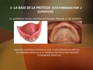 1- LA BASE DE LA PRÓTESIS ESTA FORMADA POR 2
SUPERFICIES
A) SUPERFICIE BASAL INTERNA NO PULIDA TISULAR, O DE ASIENTO.
QUE ESTA EN ÍNTIMO CONTACTO CON LA MUCOSA DE LAS CRESTAS
DEL REBORDE RESIDUAL O EL TERRENO PROTÉSICO DEL PACIENTE
TOTALMENTE EDÉNTULO
 
