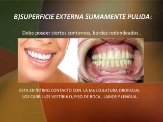 B)SUPERFICIE EXTERNA SUMAMENTE PULIDA:
Debe poseer ciertos contornos, bordes redondeados .
ESTA EN ÍNTIMO CONTACTO CON LA MUSCULATURA OROFACIAL
LOS CARRILLOS VESTÍBULO, PISO DE BOCA , LABIOS Y LENGUA.
 