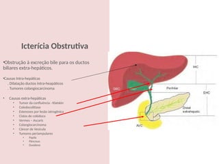 Cópia de 6) Patologia cirúrgica das vias biliares.pptx
