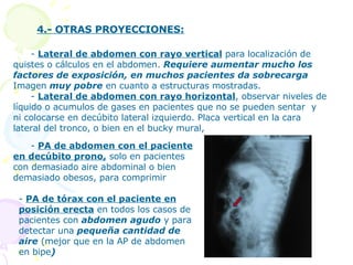 4.- OTRAS PROYECCIONES: -  Lateral de abdomen con rayo vertical  para localización de quistes o cálculos en el abdomen.  R...