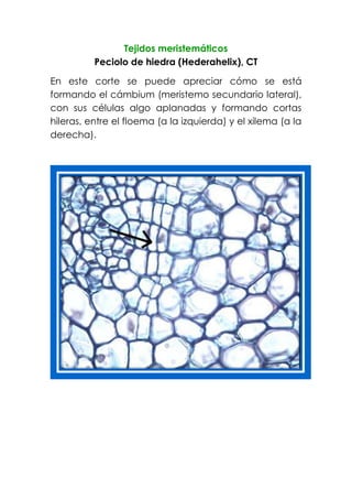 Tejidos meristemáticos
Peciolo de hiedra (Hederahelix), CT
En este corte se puede apreciar cómo se está
formando el cámbium (meristemo secundario lateral),
con sus células algo aplanadas y formando cortas
hileras, entre el floema (a la izquierda) y el xilema (a la
derecha).
 