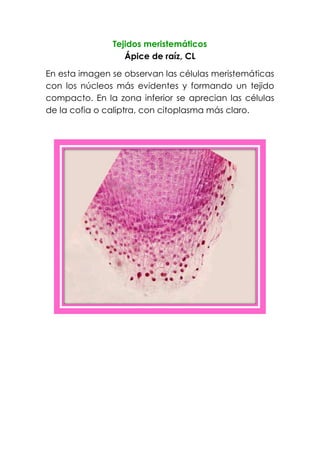 Tejidos meristemáticos
Ápice de raíz, CL
En esta imagen se observan las células meristemáticas
con los núcleos más evidentes y formando un tejido
compacto. En la zona inferior se aprecian las células
de la cofia o caliptra, con citoplasma más claro.
 