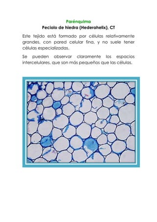 Parénquima
Peciolo de hiedra (Hederahelix), CT
Este tejido está formado por células relativamente
grandes, con pared celular fina, y no suele tener
células especializadas.
Se pueden observar claramente los espacios
intercelulares, que son más pequeños que las células.
 