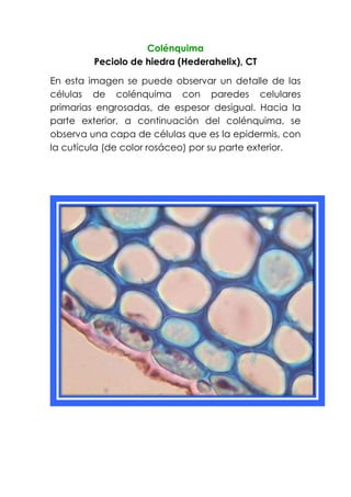 Colénquima
Peciolo de hiedra (Hederahelix), CT
En esta imagen se puede observar un detalle de las
células de colénquima con paredes celulares
primarias engrosadas, de espesor desigual. Hacia la
parte exterior, a continuación del colénquima, se
observa una capa de células que es la epidermis, con
la cutícula (de color rosáceo) por su parte exterior.
 