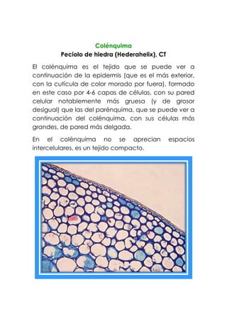 Colénquima
Peciolo de hiedra (Hederahelix), CT
El colénquima es el tejido que se puede ver a
continuación de la epidermis (que es el más exterior,
con la cutícula de color morado por fuera), formado
en este caso por 4-6 capas de células, con su pared
celular notablemente más gruesa (y de grosor
desigual) que las del parénquima, que se puede ver a
continuación del colénquima, con sus células más
grandes, de pared más delgada.
En el colénquima no se aprecian espacios
intercelulares, es un tejido compacto.
 