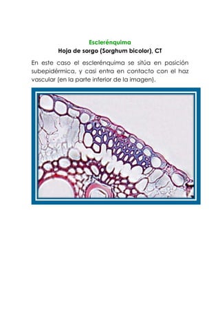 Esclerénquima
Hoja de sorgo (Sorghum bicolor), CT
En este caso el esclerénquima se sitúa en posición
subepidérmica, y casi entra en contacto con el haz
vascular (en la parte inferior de la imagen).
 