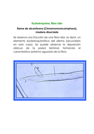 Esclerénquima, fibra xilar
Rama de alcanforero (Cinnamomumcamphora),
madera disociada
Se observa una fracción de una fibra xilar, es decir, un
elemento esclerenquimático del xilema (secundario
en este caso). Se puede observar la disposición
oblicua de la pared terminal, formando el
característico extremo aguzado de la fibra.
 