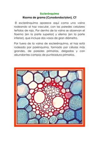 Esclerénquima
Rizoma de grama (Cynodondactylon), CT
El esclerénquima aparece aquí como una vaina
rodeando al haz vascular, con las paredes celulares
teñidas de rojo. Por dentro de la vaina se observan el
floema (en la parte superior) y xilema (en la parte
inferior), que incluye dos vasos de gran diámetro.
Por fuera de la vaina de esclerénquima, el haz está
rodeado por parénquima, formado por células más
grandes, de paredes primarias, delgadas y con
abundantes campos de punteadura primarios.
 