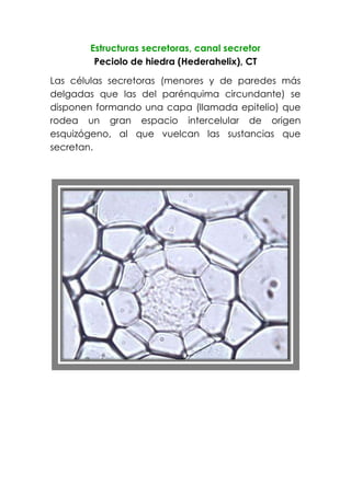 Estructuras secretoras, canal secretor
Peciolo de hiedra (Hederahelix), CT
Las células secretoras (menores y de paredes más
delgadas que las del parénquima circundante) se
disponen formando una capa (llamada epitelio) que
rodea un gran espacio intercelular de origen
esquizógeno, al que vuelcan las sustancias que
secretan.
 