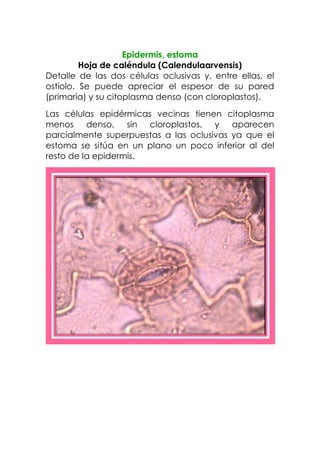 Epidermis, estoma
Hoja de caléndula (Calendulaarvensis)
Detalle de las dos células oclusivas y, entre ellas, el
ostiolo. Se puede apreciar el espesor de su pared
(primaria) y su citoplasma denso (con cloroplastos).
Las células epidérmicas vecinas tienen citoplasma
menos denso, sin cloroplastos, y aparecen
parcialmente superpuestas a las oclusivas ya que el
estoma se sitúa en un plano un poco inferior al del
resto de la epidermis.
 
