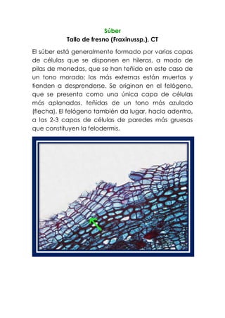 Súber
Tallo de fresno (Fraxinussp.), CT
El súber está generalmente formado por varias capas
de células que se disponen en hileras, a modo de
pilas de monedas, que se han teñido en este caso de
un tono morado; las más externas están muertas y
tienden a desprenderse. Se originan en el felógeno,
que se presenta como una única capa de células
más aplanadas, teñidas de un tono más azulado
(flecha). El felógeno también da lugar, hacia adentro,
a las 2-3 capas de células de paredes más gruesas
que constituyen la felodermis.
 