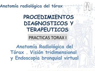 PROCEDIMIENTOS DIAGNOSTICOS Y TERAPEUTICOS  Anatomía Radiológica del Tórax . Visión tridimensional  y Endoscopia bronquial virtual PRACTICAS TORAX I 