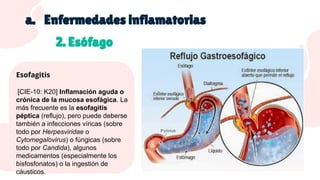 Esofagatis Copia de Aparato digestivo II PARTE DOS CON PARTES | PDF