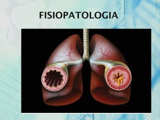 FISIOPATOLOGIA
 