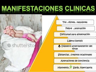 Tos , disnea , taquipnea
Fiebre , postración
Dificultad para alimentación
Ligera cianosis
Diámetro anteroposterior del
tórax
Sibilancias , crepitos ocasionales
Alteraciones de conciencia
Hipoxemia , SaHb, hipercapnia
 