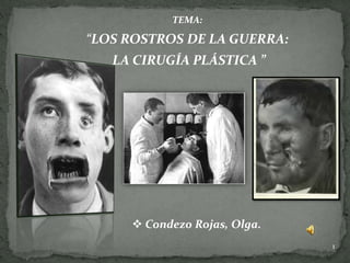 TEMA:

“LOS ROSTROS DE LA GUERRA:
   LA CIRUGÍA PLÁSTICA ”




      Condezo Rojas, Olga.
                              1
 