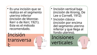 Técnica de cesárea en los diferentes tipos | PPTX