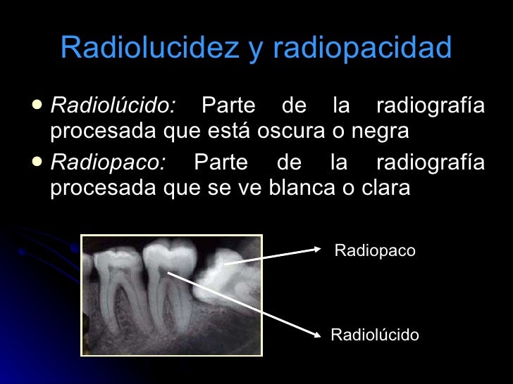 Resultado de imagen para radiolucido y radiopaco