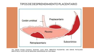 TIPOSDEDESPRENDIMIENTOPLACENTARIO
Dra. Dakota Viruega Cuaresma. Santander, (Junio 2016). ABRUPTIO PLACENTAE: UNA GRAVE PATOLOGÍA
OBSTÉTRICA. FACULTAD DE MEDICINA UNIVERSIDAD DE CANTABRIA
 