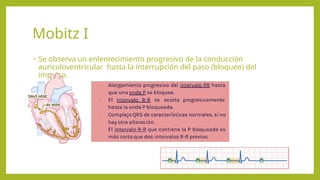 BLOQUEO AURICULO VENTRICULAR EN PACIENTE CRITICO. | PPTX