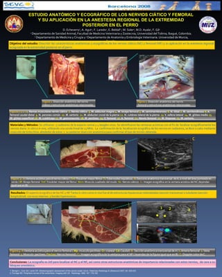 ESTUDIO ANATÓMICO Y ECOGRÁFICO DE LOS NERVIOS CIÁTICO Y FEMORAL Y SU APLICACIÓN EN LA ANESTESIA REGIONAL DE LA EXTREMIDAD POSTERIOR EN EL PERRO  D. Echeverry 1 , A. Agut 2 , F. Laredo 2 , E. BeldaF 2 , M. Soler 2 , M.D. Ayala 3 , F. Gil 3 1  Departamento de Sanidad Animal, Facultad de Medicina Veterinaria y Zootecnia, Universidad del Tolima, Ibagué, Colombia.  2  Departamento de Medicina y Cirugía y  3  Departamento de Anatomía y Embriología Veterinaria. Universidad de Murcia, España. 1. Benigni L, Coor SA, Lamb CR.  Ultrasonographic assessment of the canine sciatic nerve. Veterinary Radiology & Ultrasound 2007; 48: 428-433 2. Fornage BD. Peripheral nerves of the extremities: Imaging with US.  Radiology 1988; 167: 179-182 Objetivo del estudio :  Describir las características anatómicas y ecográficas de los nervios ciático (NC) y femoral (NF) y su aplicación en la anestesia regional ecoguiada en la extremidad posterior en el perro.  Materiales y Métodos:  Se utilizaron  5 cadáveres de la especie canina y 4 beagles vivos. Se identificaron las ventanas acústicas con el fin de  localizar ecográficamente los nervios diana  in vitro e in vivo,  utilizando una sonda lineal de 13 MHz.  La  confirmación de la  localización ecográfica de los nervios en cadáveres, se llevo a cabo mediante inyección de tinta china  alrededor de estos  y  su posterior disección anatómica para confirmar el tipo de tinción obtenida. Resultados:  El aspecto ecográfico de los NC y NF  Tanto  in vitro  como  in vivo  fue el de estructuras hipoecoicas redondeadas (sección transversa) o tubulares (sección longitudinal)  con ecos internos  y bordes hiperecoicos.  Conclusiones:  La ecografía es útil para localizar el NC y el NF, así como otras estructuras anatómicas de importancia relacionadas con estos nervios,  de cara a su bloqueo anestésico. 1 4 3 5 8 6 9 7 2 10 14 15 11 12 13 16 17 Mcm Bf Tmf Bf Mcm Nc Tmf Nc Tmf Ti A B 18 19 20 21 22 23 proximal craneal Pared abdominal 3 1 2 Nf Cara interna muslo A B C D C 