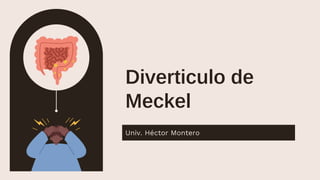 Diverticulo de
Meckel
Univ. Héctor Montero
 