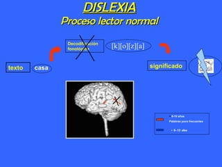 DISLEXIA Proceso lector normal texto Decodificación fonológica significado casa [k][o][z][a] <  8-10 años Palabras poco frecuentes > 8-10 años 
