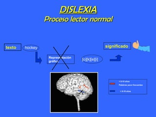 DISLEXIA Proceso lector normal texto Representación gráfica significado < 8-10 años Palabras poco frecuentes > 8-10 años hockey [o][k][e][i] 