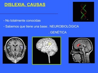 DISLEXIA. CAUSAS - No totalmente conocidas  Sabemos que tiene una base:. NEUROBIOLÒGICA . GENÈTICA 