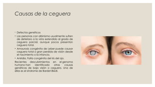 Causas de la ceguera
◦ Defectos genéticos
• Las personas con albinismo usualmente sufren
de deterioro a la vista extendido al grado de
ceguera parcial, aunque pocos presentan
ceguera total.
• Amaurosis congénita de Leber puede causar
ceguera total o gran perdida de visión desde
el nacimiento o la infancia.
• Aniridia. Falta congénita del iris del ojo.
Recientes descubrimientos en el genoma
humano han identificado otras causas
genéticas de baja visión o ceguera. Una de
ellas es el síndrome de Bardet-Biedl.
 