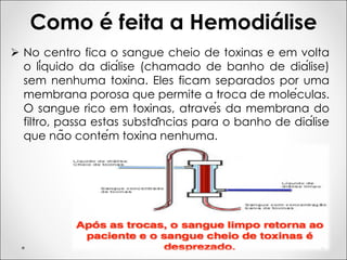 Como é feita a Hemodiálise
Ø No centro fica o sangue cheio de toxinas e em volta
o líquido da diálise (chamado de banho de diálise)
sem nenhuma toxina. Eles ficam separados por uma
membrana porosa que permite a troca de moléculas.
O sangue rico em toxinas, através da membrana do
filtro, passa estas substâncias para o banho de diálise
que não contém toxina nenhuma.
 
