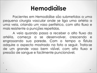Hemodiálise
Pacientes em Hemodiálise são submetidos a uma
pequena cirurgia vascular onde se liga uma artéria a
uma veia, criando um vaso periférico, com alto fluxo e
mais resistente a punções repetidas.
A veia quando passa a receber o alto fluxo da
artéria, começa a se desenvolver, crescendo e
engrossando sua parede. Com o tempo a fístula
adquire o aspecto mostrado na foto a seguir. Trata-se
de um grande vaso bem visível, com alto fluxo e
pressão de sangue e facilmente puncionável.
.
 
