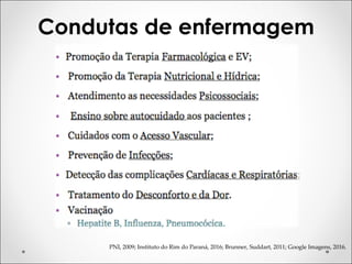 Condutas de enfermagem
PNI, 2009; Instituto do Rim do Paraná, 2016; Brunner, Suddart, 2011; Google Imagens, 2016.
 