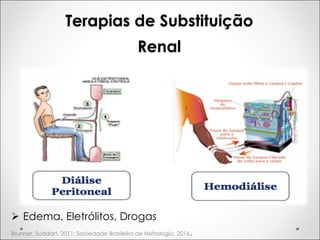 Terapias de Substituição
Renal
Ø Edema, Eletrólitos, Drogas
Brunner, Suddart, 2011; Sociedade Brasileira de Nefrologia, 2016.
 