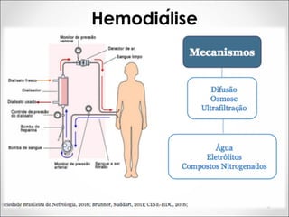 Hemodiálise
 