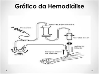 Gráfico da Hemodiálise
 