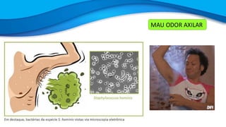 MAU ODOR AXILAR
 