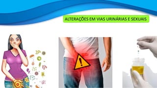 ALTERAÇÕES EM VIAS URINÁRIAS E SEXUAIS
 