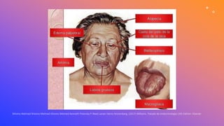 Shlomo Melmed Shlomo Melmed Shlomo Melmed Kenneth Polonsky P. Reed Larsen Henry Kronenberg. (2017) Williams. Tratado de endocrinología 13th Edition. Elsevier
 