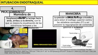 Como realizar de intubacion_orotraqueal.pptx