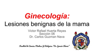 Ginecología:
Lesiones benignas de la mama
Victor Rafael Huerta Reyes
Sección 06
Dr. Carlos Guzman Nava
Facultad de Ciencias Medicas Y Biologicas “Dr. Ignacio Chavez”
 