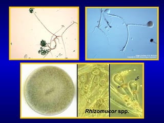 Rhizomucor spp.
 