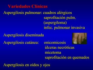 Variedades ClínicasVariedades Clínicas
Aspergilosis pulmonar: cuadros alérgicosAspergilosis pulmonar: cuadros alérgicos
saprofitación pulm.saprofitación pulm.
(aspergiloma)(aspergiloma)
infec. pulmonar invasivainfec. pulmonar invasiva
Aspergilosis diseminadaAspergilosis diseminada
Aspergilosis cutánea: onicomicosisAspergilosis cutánea: onicomicosis
úlceras necróticasúlceras necróticas
micetomamicetoma
saprofitación en quemadossaprofitación en quemados
Aspergilosis en oídos y ojosAspergilosis en oídos y ojos
 