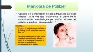 Maniobra de Politzer
• Consiste en la insuflación de aire a través de las fosas
nasales a la vez que provocamos el cierre de la
comunicación nasofaríngea por acción del velo del
paladar y apertura fisiológica de la trompa.
 