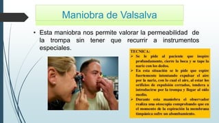Maniobra de Valsalva
• Esta maniobra nos permite valorar la permeabilidad de
la trompa sin tener que recurrir a instrumentos
especiales.
 