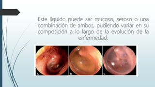 Este líquido puede ser mucoso, seroso o una
combinación de ambos, pudiendo variar en su
composición a lo largo de la evolución de la
enfermedad.
 