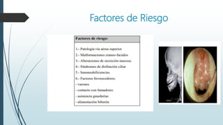 Factores de Riesgo
 