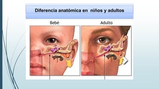 Diferencia anatómica en niños y adultos
 
