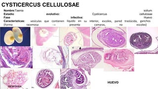 CYSTICERCUS CELLULOSAE
Nombre:Taenia solium
Estadio evolutivo: Cysticercus cellulosae
Fase
Características: vesículas que contienen
infectiva:
líquido en su interior, escolex, pared traslúcida,
Huevo
ganchos
(Forma racemosa → presenta camaras, no escolex)
racemosa
HUEVO
 